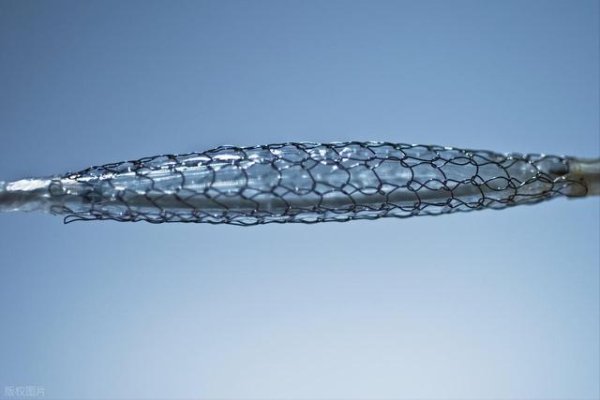 一旦装上心脏支架，还能活多少年？医生不再隐瞒，说出了实话